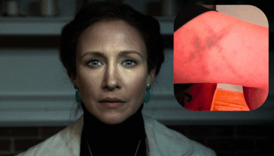 Vera Farmiga Revela Misteriosos Moretones en Forma de Cruz: ¿Una Maldición de 'The Conjuring'?