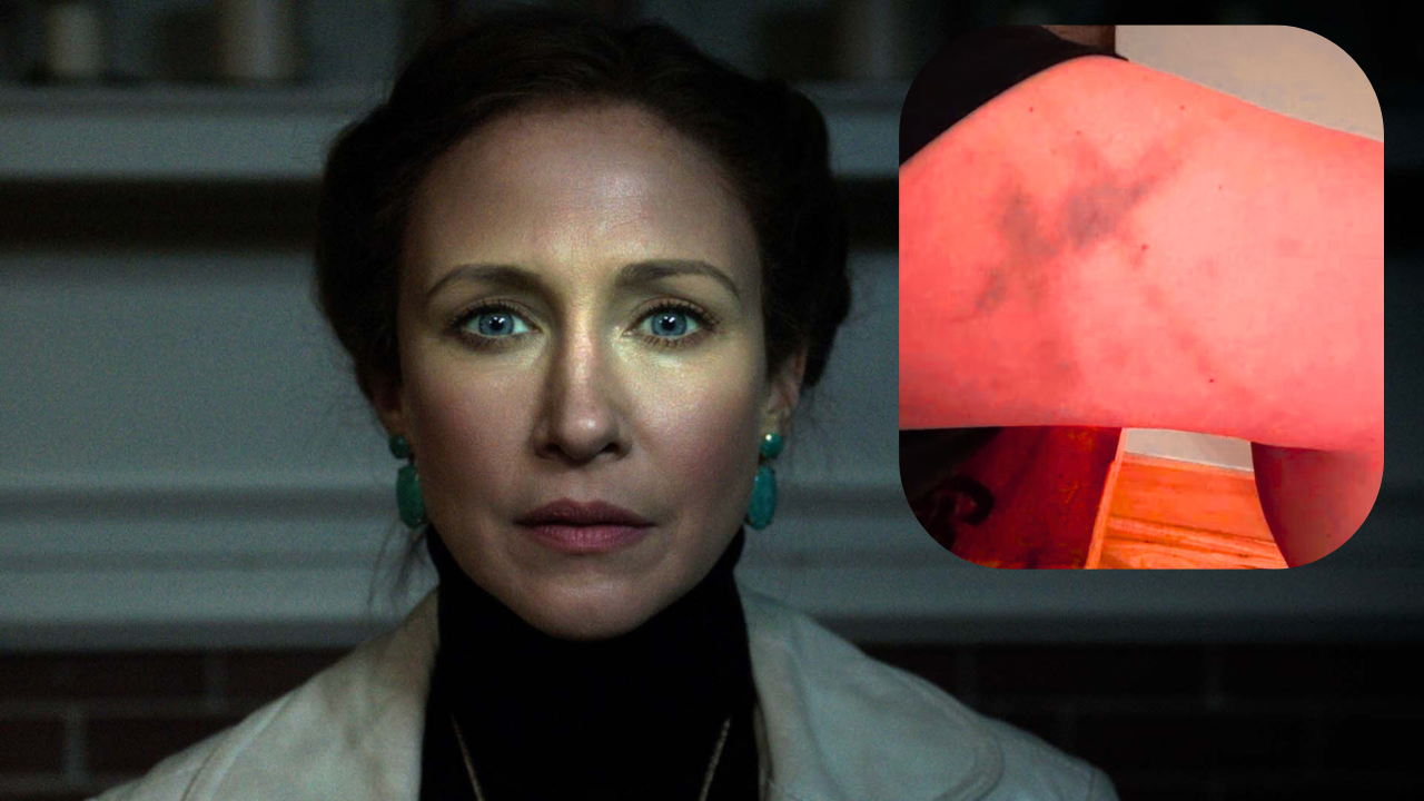 Vera Farmiga Revela Misteriosos Moretones en Forma de Cruz: ¿Una Maldición de 'The Conjuring'?